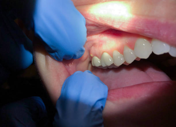 Best After-Hours Dental Trauma Care in Spry, PA